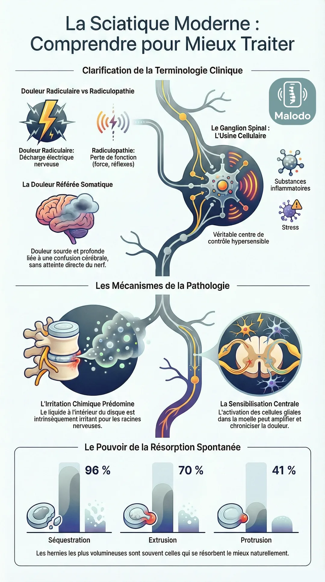 Infographie Malodo : la sciatique moderne, comprendre son mécanisme